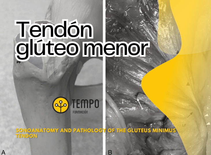 tendon-gluteo-menor-anatomia-y-ecografia